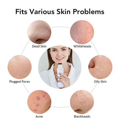 Ultradźwiękowy skraber do twarzy – peeling jonowy, lifting 4 tryby — Urządzenia beauty — EldoradoShop
